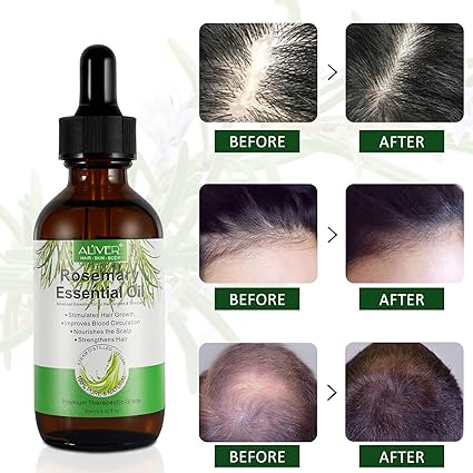 Rosemary Oil for Hair Growth 2 Fl Oz, Pure Organic Rosemary Essential Oils Serum for Dry Damaged Hair and Growth, Hair Loss Scalp Treatment